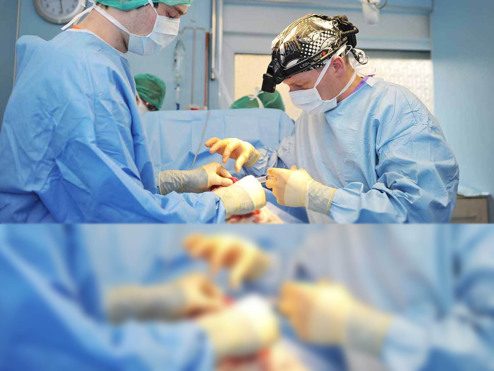 Abdomen Surgery in Jalandhar