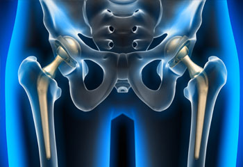 hip and knee joints replacements doctor in jalandhar