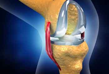 Joint replacement in jalandhar